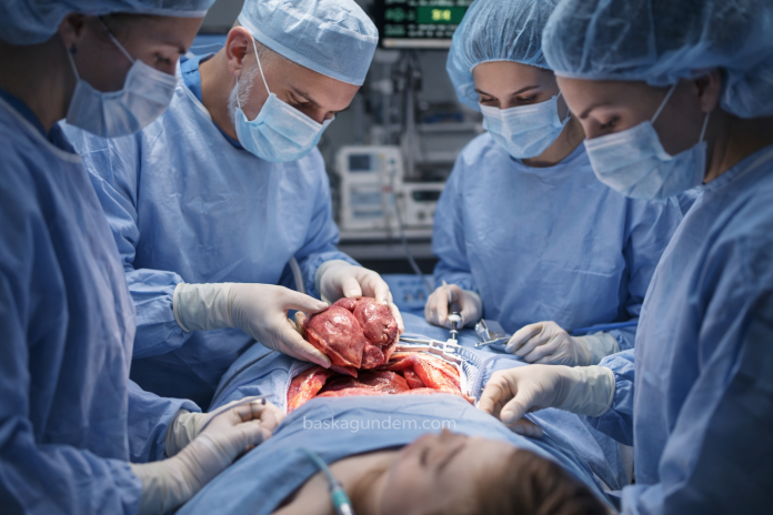 Organ Nakli - Başka Gündem - baskagundem.com